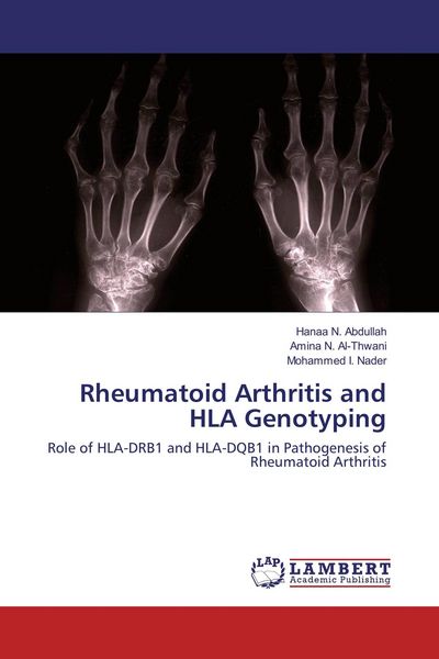 Produktbild: Rheumatoid Arthritis and HLA Genotyping