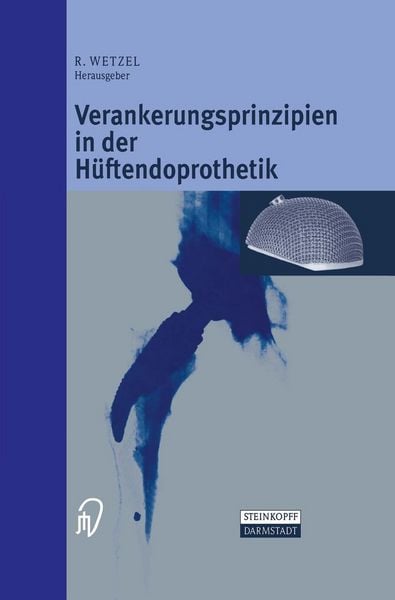 Produktbild: Verankerungsprinzipien in der H&uuml;ftendoprothetik