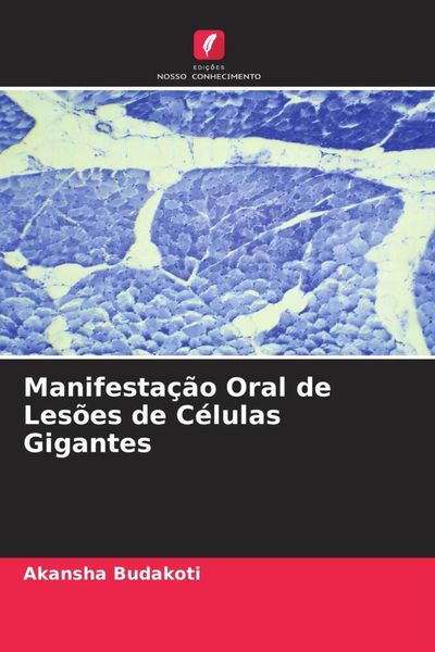 Produktbild: Manifesta&ccedil;&atilde;o Oral de Les&otilde;es de C&eacute;lulas Gigantes