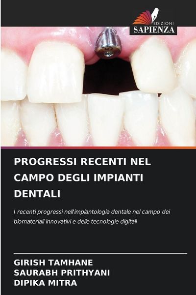 Produktbild: PROGRESSI RECENTI NEL CAMPO DEGLI IMPIANTI DENTALI