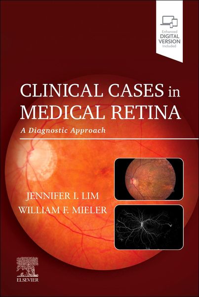 Produktbild: Clinical Cases in Medical Retina