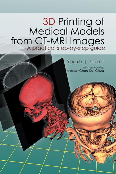 Produktbild: 3D Printing of Medical Models from Ct-Mri Images