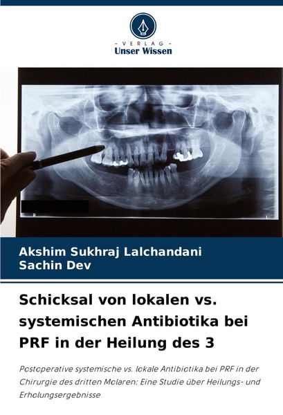 Schicksal von lokalen vs. systemischen Antibiotika bei PRF in der Heilung des 3, Taschenbuch von Akshim Sukhraj Lalchandani , Sachin Dev, Verlag Unser
