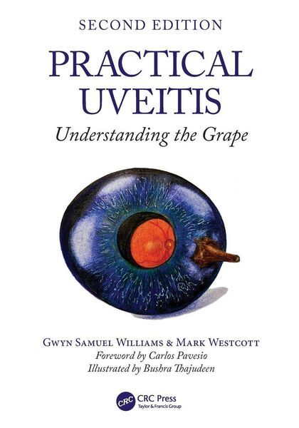 Produktbild: Practical Uveitis