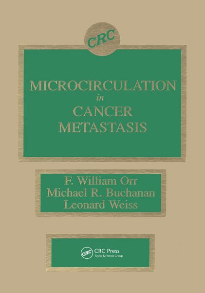 Produktbild: Microcirculation in Cancer Metastasis