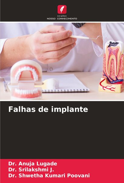 Produktbild: Falhas de implante