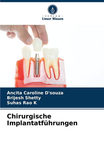 Produktbild: Chirurgische Implantatf&uuml;hrungen
