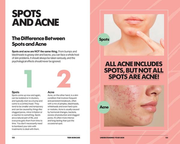 Produktbild: Teen Skincare