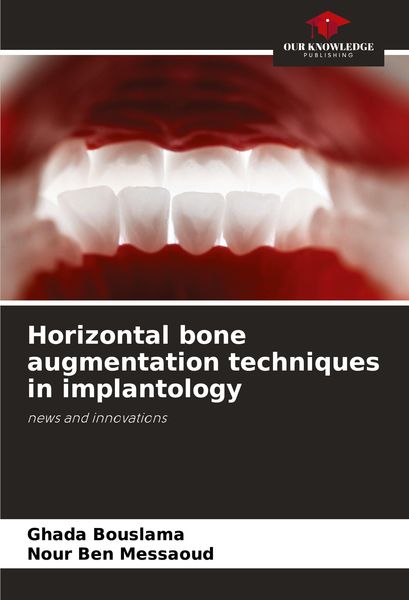 Produktbild: Horizontal bone augmentation techniques in implantology