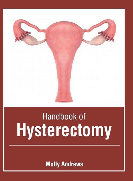 Produktbild: Handbook of Hysterectomy
