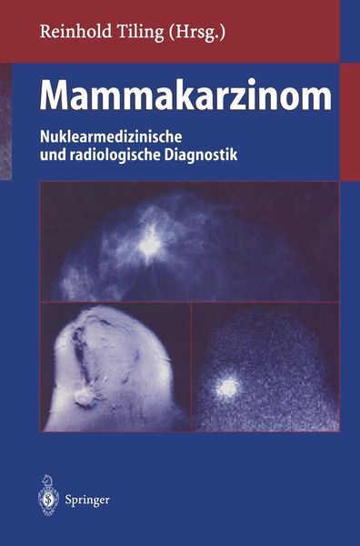 Produktbild: Mammakarzinom