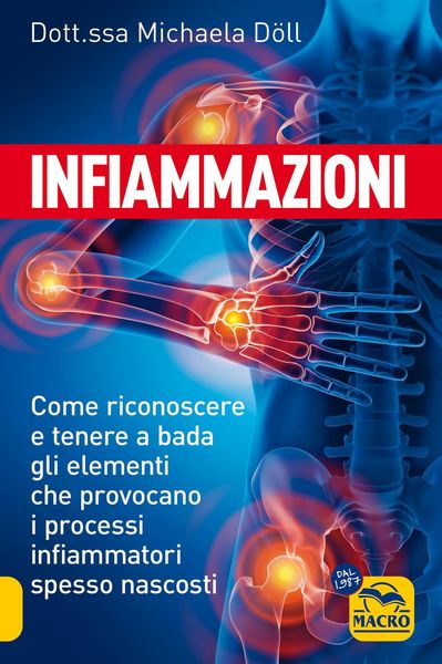 Produktbild: Infiammazioni. Come riconoscere e tenere a bada gli elementi che provocano i processi infiammatori spesso nascosti