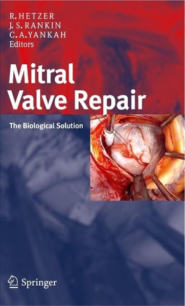 Produktbild: Mitral Valve Repair