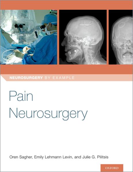 Produktbild: Pain Neurosurgery