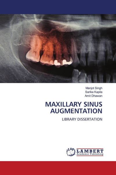 Produktbild: Maxillary Sinus Augmentation