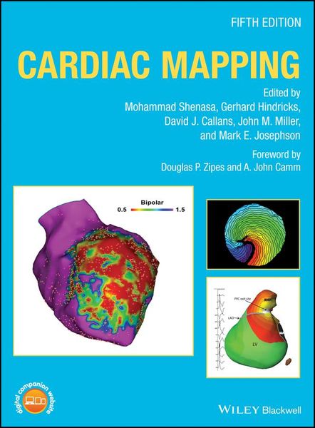 Produktbild: Cardiac Mapping