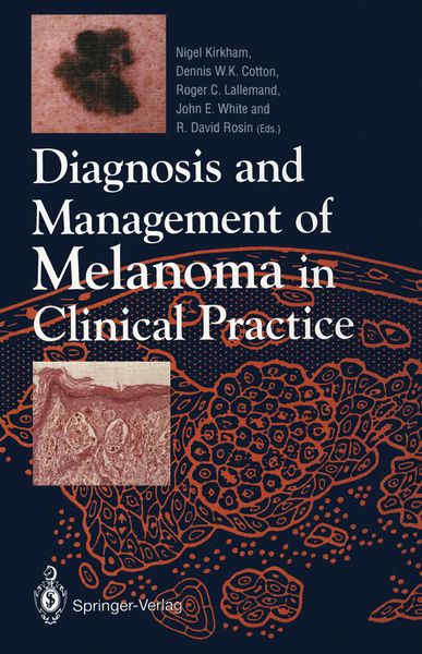 Produktbild: Diagnosis and Management of Melanoma in Clinical Practice