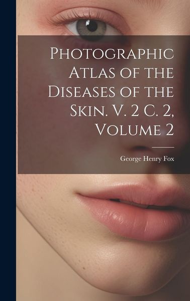 Produktbild: Photographic Atlas of the Diseases of the Skin. V. 2 C. 2, Volume 2