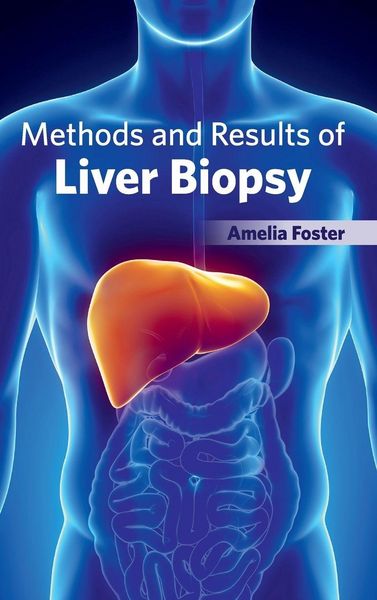 Produktbild: Methods and Results of Liver Biopsy