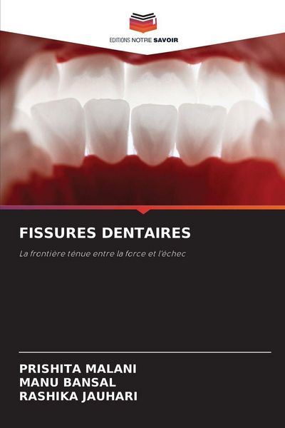Produktbild: Fissures Dentaires