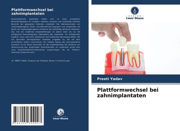 Plattformwechsel bei zahnimplantaten, Taschenbuch von Preeti Yadav, Verlag Unser Wissen, 9786204344027