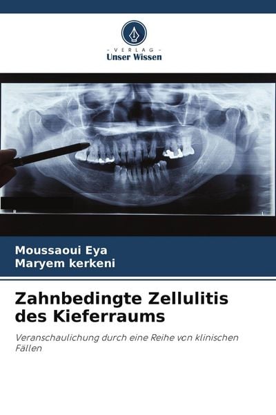 Zahnbedingte Zellulitis des Kieferraums, Taschenbuch von Moussaoui Eya , Maryem kerkeni, Verlag Unser Wissen, 9786205024751