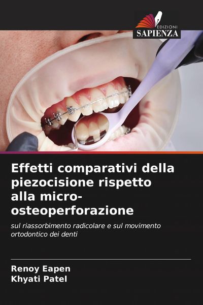 Produktbild: Effetti comparativi della piezocisione rispetto alla micro-osteoperforazione