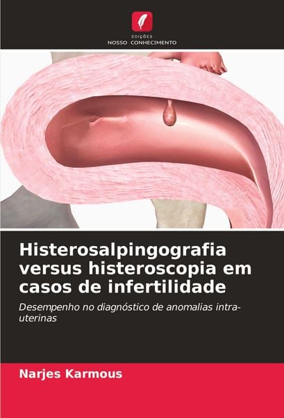 Produktbild: Histerosalpingografia versus histeroscopia em casos de infertilidade