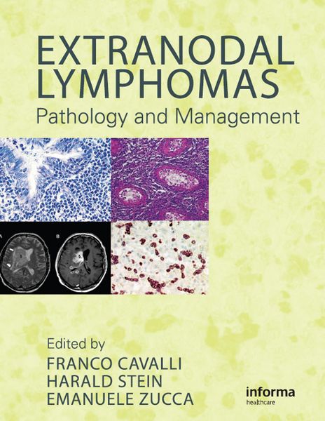 Produktbild: Extranodal Lymphomas
