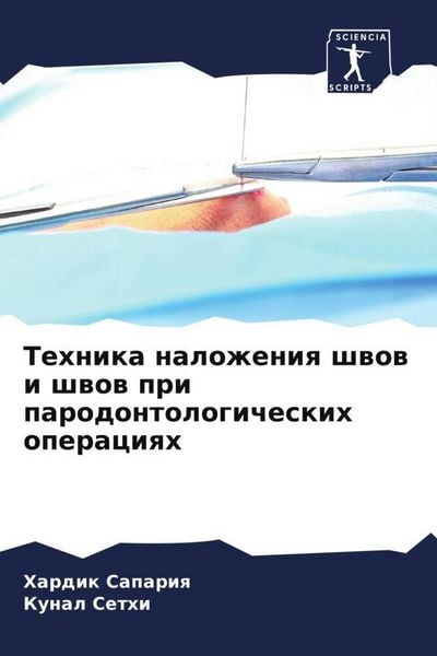 Produktbild: Tehnika nalozheniq shwow i shwow pri parodontologicheskih operaciqh