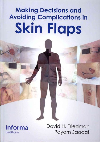Produktbild: Making Decisions and Avoiding Complications in Skin Flaps