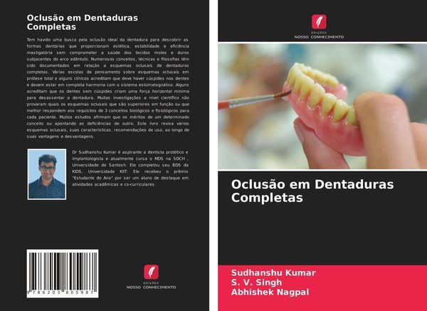 Produktbild: Oclus&atilde;o em Dentaduras Completas