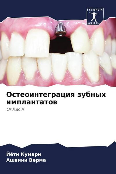 Produktbild: Osteointegraciq zubnyh implantatow