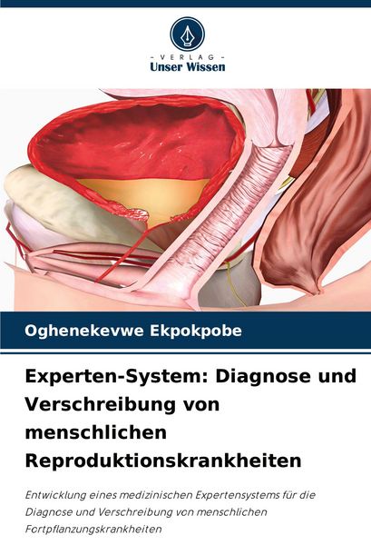 Produktbild: Experten-System: Diagnose und Verschreibung von menschlichen Reproduktionskrankheiten
