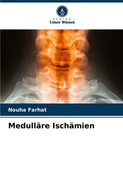 Produktbild: Medull&auml;re Isch&auml;mien