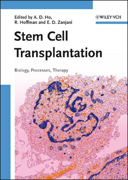 Produktbild: Stem Cell Transplantation