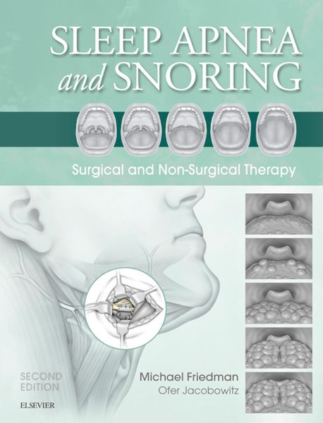Produktbild: Sleep Apnea and Snoring E-Book