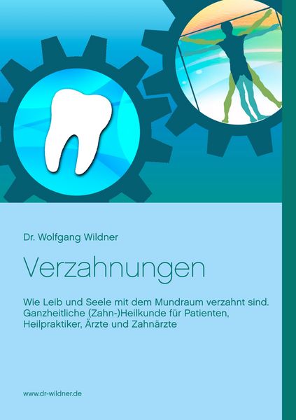 Produktbild: Verzahnungen