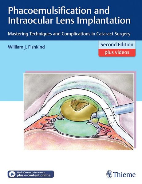 Produktbild: Phacoemulsification and Intraocular Lens Implantation