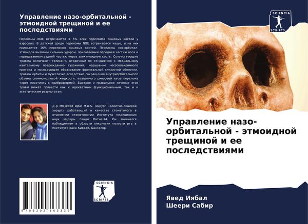 Produktbild: Uprawlenie nazo-orbital'noj - &auml;tmoidnoj treschinoj i ee posledstwiqmi