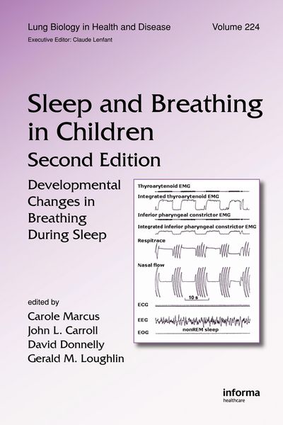 Produktbild: Sleep and Breathing in Children