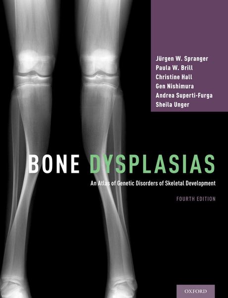 Produktbild: Bone Dysplasias
