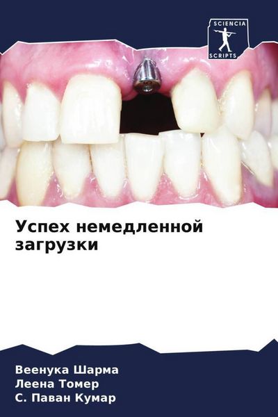 Produktbild: Uspeh nemedlennoj zagruzki