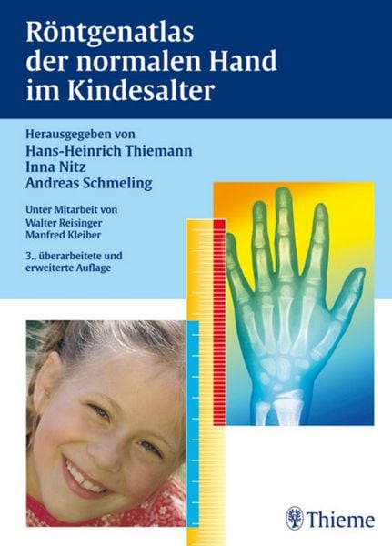 Produktbild: R&ouml;ntgenatlas der normalen Hand im Kindesalter