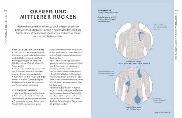 Produktbild: Triggerpunkte