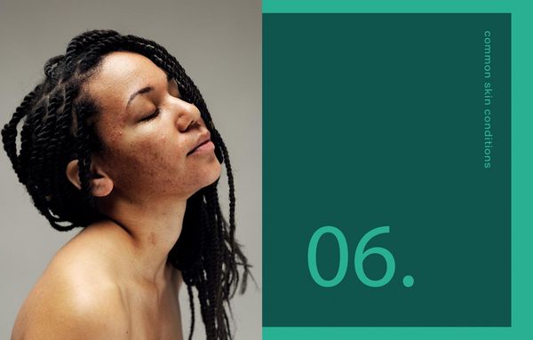 Produktbild: Black Skin