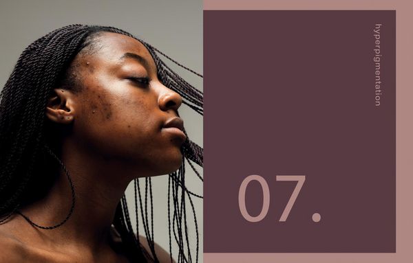 Produktbild: Black Skin