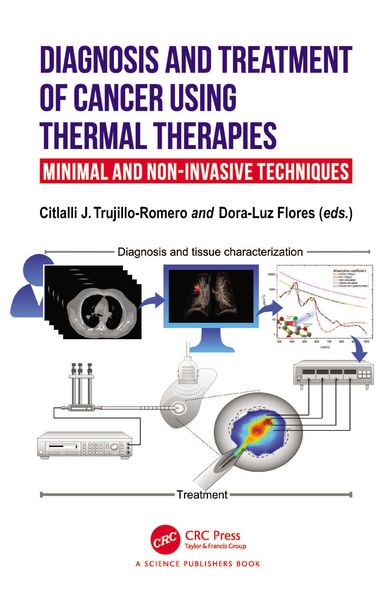Produktbild: Diagnosis and Treatment of Cancer using Thermal Therapies