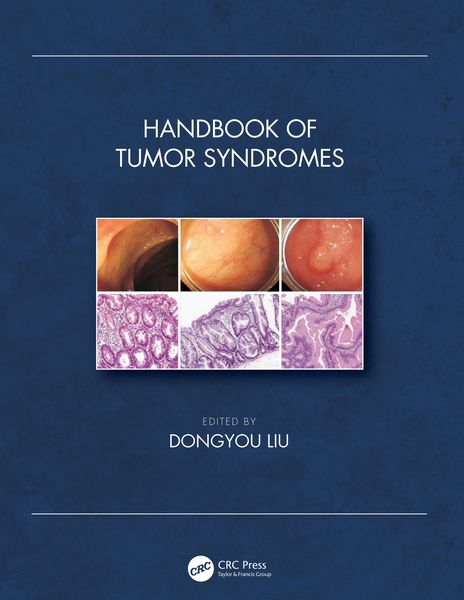 Produktbild: Handbook of Tumor Syndromes