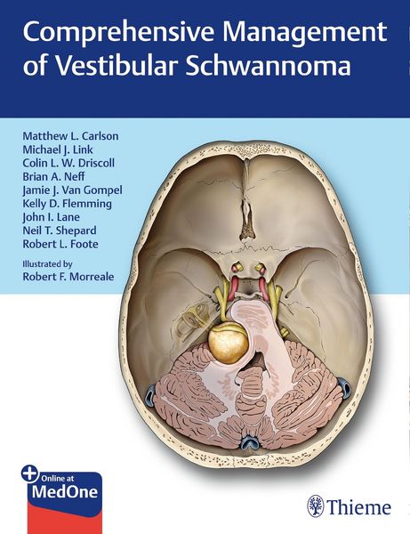 Produktbild: Comprehensive Management of Vestibular Schwannoma